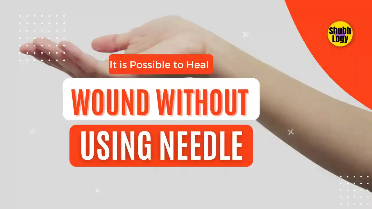 Is it possible to heal a wound without using a needle? using Dermaclip